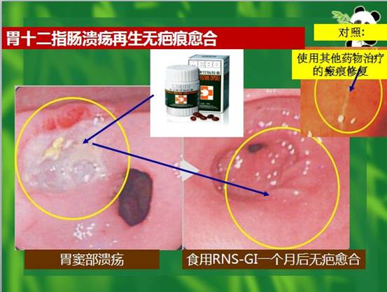 �Ϲ�NG��28(�й���)����Ʒ���������޹�˾